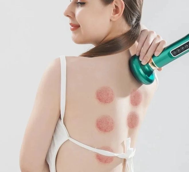 Cupping Massager фото