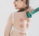 Cupping Massager фото 7